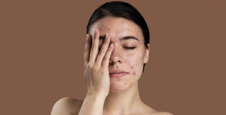skin health and your microbiome